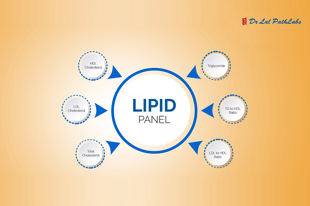 Lipid-Profile-Test-01